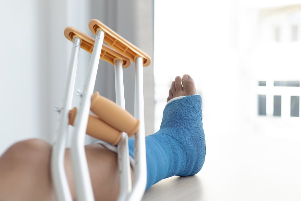 Foot with a Cast and Crutches